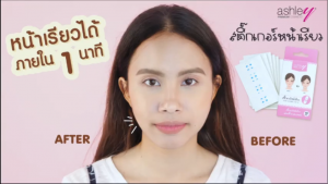 Review: สติ๊กเกอร์แปะเหนียง หน้าเรียวทันใจ ไม่ง้อศัลยกรรม